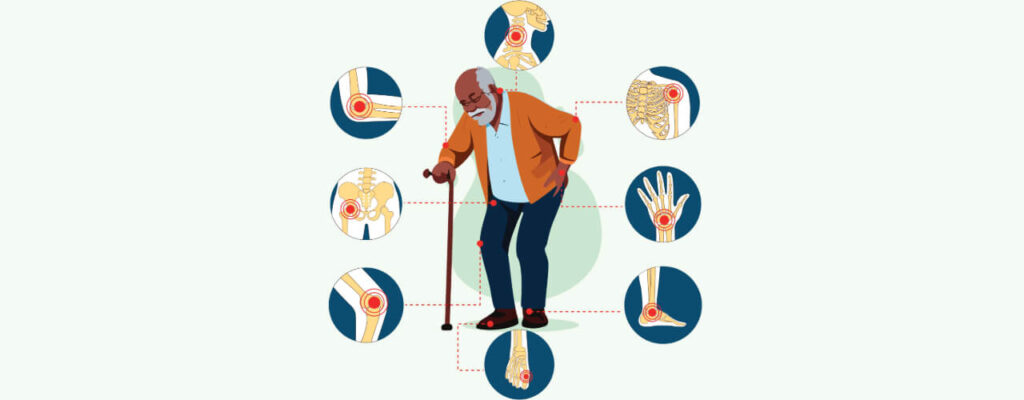 Easing Arthritis Pain with Manual Therapy
